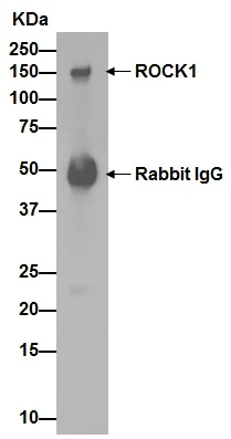Immunoprecipitation - Anti-ROCK2 + ROCK1 antibody [EP786Y] - BSA and Azide free (AB219587)