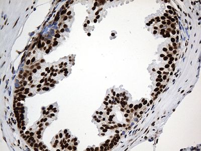 Immunohistochemistry (Formalin/PFA-fixed paraffin-embedded sections) - Anti-ROD1 antibody [OTI5G7] (ab236407), expandable thumbnail