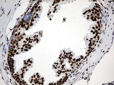 Immunohistochemistry (Formalin/PFA-fixed paraffin-embedded sections) - Anti-ROD1 antibody [OTI5G7] (AB236407)
