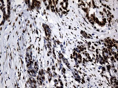 Immunohistochemistry (Formalin/PFA-fixed paraffin-embedded sections) - Anti-ROD1 antibody [OTI5G7] (AB236407)
