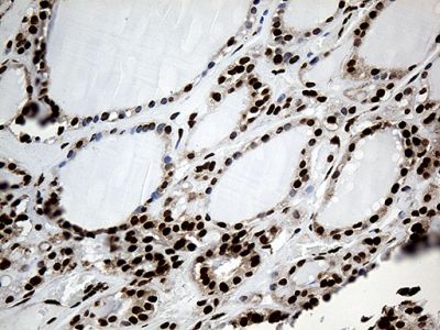 Immunohistochemistry (Formalin/PFA-fixed paraffin-embedded sections) - Anti-ROD1 antibody [OTI5G7] (ab236407), expandable thumbnail