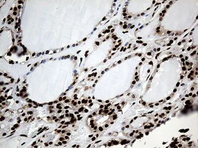 Immunohistochemistry (Formalin/PFA-fixed paraffin-embedded sections) - Anti-ROD1 antibody [OTI5G7] (AB236407)