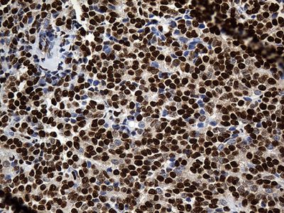 Immunohistochemistry (Formalin/PFA-fixed paraffin-embedded sections) - Anti-ROD1 antibody [OTI5G7] (AB236407), expandable thumbnail