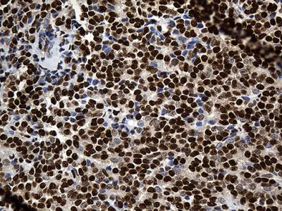 Immunohistochemistry (Formalin/PFA-fixed paraffin-embedded sections) - Anti-ROD1 antibody [OTI5G7] (AB236407)