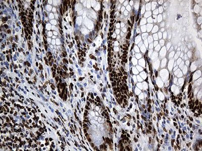 Immunohistochemistry (Formalin/PFA-fixed paraffin-embedded sections) - Anti-ROD1 antibody [OTI5G7] (AB236407)