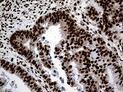 Immunohistochemistry (Formalin/PFA-fixed paraffin-embedded sections) - Anti-ROD1 antibody [OTI5G7] (ab236407), expandable thumbnail