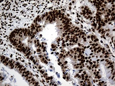 Immunohistochemistry (Formalin/PFA-fixed paraffin-embedded sections) - Anti-ROD1 antibody [OTI5G7] (AB236407)