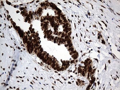 Immunohistochemistry (Formalin/PFA-fixed paraffin-embedded sections) - Anti-ROD1 antibody [OTI5G7] (ab236407), expandable thumbnail