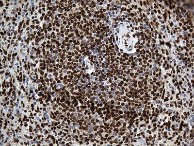 Immunohistochemistry (Formalin/PFA-fixed paraffin-embedded sections) - Anti-ROD1 antibody [OTI5G7] (AB236407)