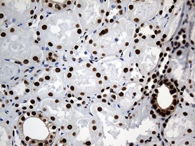 Immunohistochemistry (Formalin/PFA-fixed paraffin-embedded sections) - Anti-ROD1 antibody [OTI5G7] (ab236407), expandable thumbnail