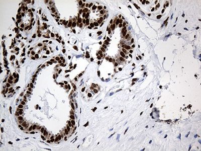 Immunohistochemistry (Formalin/PFA-fixed paraffin-embedded sections) - Anti-ROD1 antibody [OTI5G7] (AB236407), expandable thumbnail
