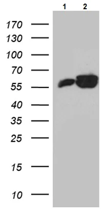 Western blot - Anti-ROD1 antibody [OTI5G7] (AB236407)