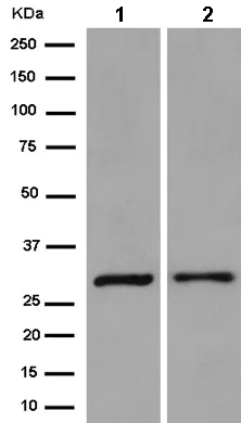 Western blot - Anti-ROGDI antibody [EPR15190] - BSA and Azide free (AB250791)