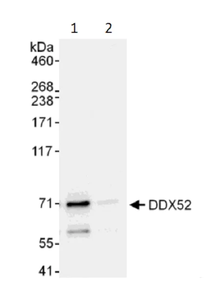 Immunoprecipitation - Anti-ROK1 antibody (AB225708)
