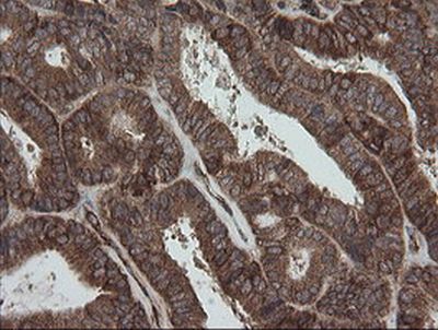 Immunohistochemistry (Formalin/PFA-fixed paraffin-embedded sections) - Anti-ROMO1 antibody [OTI2C12] (ab236409), expandable thumbnail