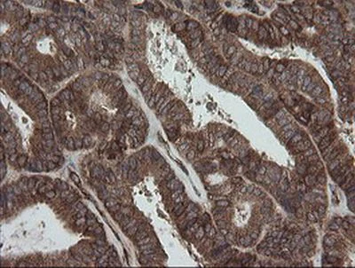 Immunohistochemistry (Formalin/PFA-fixed paraffin-embedded sections) - Anti-ROMO1 antibody [OTI2C12] (AB236409)