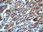 Immunohistochemistry (Formalin/PFA-fixed paraffin-embedded sections) - Anti-RON antibody [EP1132Y] (AB52927)
