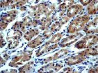 Immunohistochemistry (Formalin/PFA-fixed paraffin-embedded sections) - Anti-RON antibody [EP1132Y] - BSA and Azide free (AB170717)