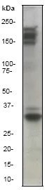 Western blot - Anti-RON antibody [EP1132Y] - BSA and Azide free (AB170717)
