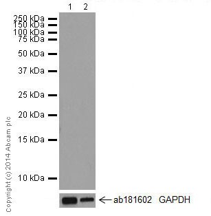 Western blot - Anti-RON antibody [EPR16789] - BSA and Azide free (AB251281), expandable thumbnail