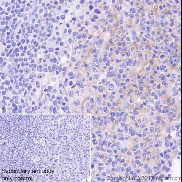 Immunohistochemistry (Formalin/PFA-fixed paraffin-embedded sections) - Anti-RON antibody [EPR20953] (AB227980)
