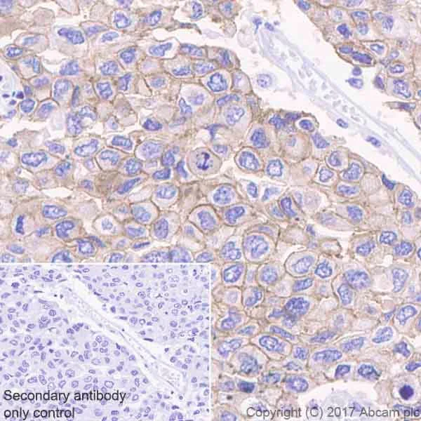 Immunohistochemistry (Formalin/PFA-fixed paraffin-embedded sections) - Anti-RON antibody [EPR20953] (AB227980)
