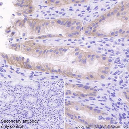 Immunohistochemistry (Formalin/PFA-fixed paraffin-embedded sections) - Anti-RON antibody [EPR20953] (AB227980)