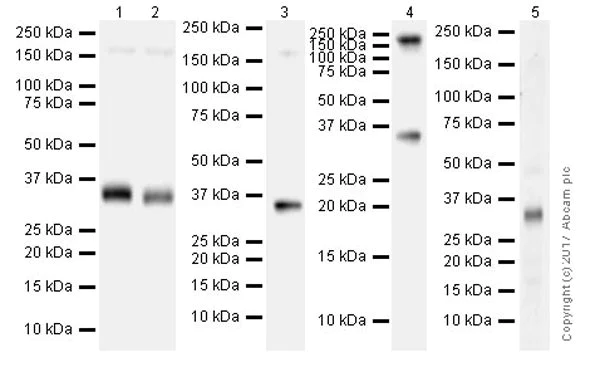 Western blot - Anti-RON antibody [EPR20953] (AB227980)