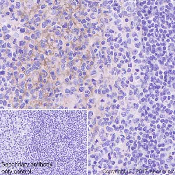 Immunohistochemistry (Formalin/PFA-fixed paraffin-embedded sections) - Anti-RON antibody [EPR20954] (AB227979), expandable thumbnail