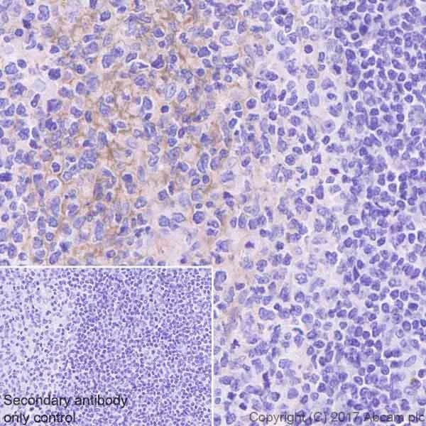 Immunohistochemistry (Formalin/PFA-fixed paraffin-embedded sections) - Anti-RON antibody [EPR20954] (AB227979)