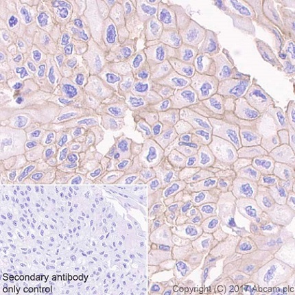Immunohistochemistry (Formalin/PFA-fixed paraffin-embedded sections) - Anti-RON antibody [EPR20954] (AB227979), expandable thumbnail