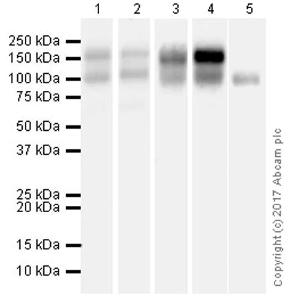 Western blot - Anti-RON antibody [EPR20954] (AB227979)