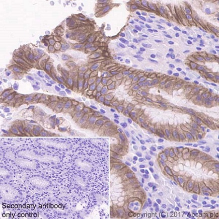 Immunohistochemistry (Formalin/PFA-fixed paraffin-embedded sections) - Anti-RON antibody [EPR20954] - BSA and Azide free (AB228853)