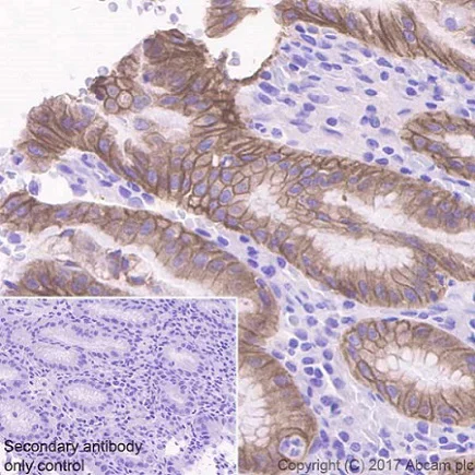 Immunohistochemistry (Formalin/PFA-fixed paraffin-embedded sections) - Anti-RON antibody [EPR20954] - BSA and Azide free (AB228853)