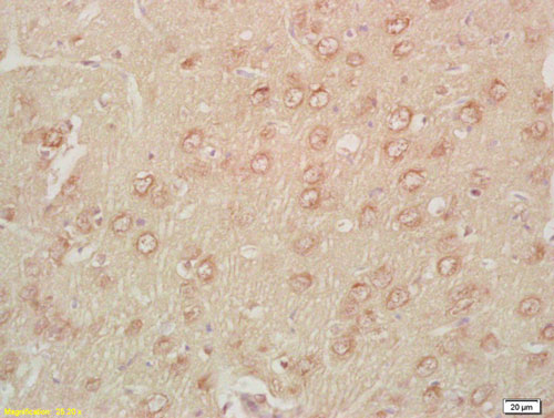 Immunohistochemistry (Formalin/PFA-fixed paraffin-embedded sections) - Anti-RON (phospho Y1238) antibody (AB203752)