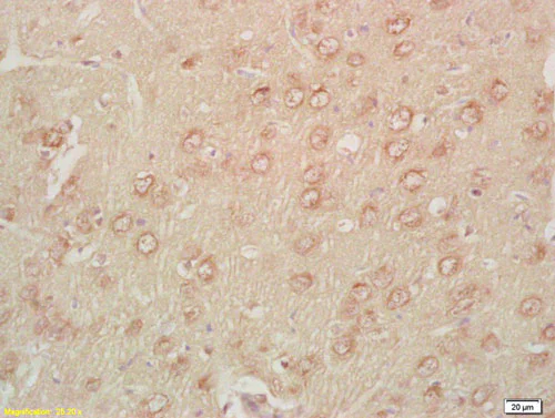 Immunohistochemistry (Formalin/PFA-fixed paraffin-embedded sections) - Anti-RON (phospho Y1238) antibody (AB203752)