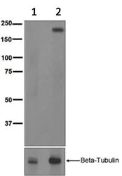 Western blot - Anti-RON (phospho Y1353) antibody [EPR5598] (AB124671)