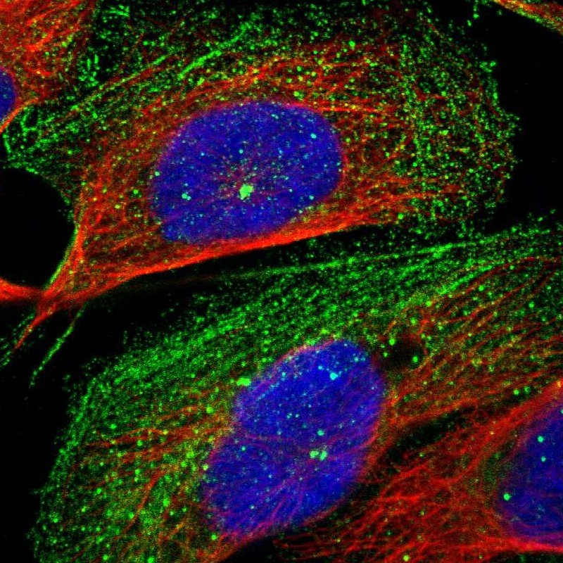 Immunocytochemistry - Anti-Rootletin antibody (AB121653), expandable thumbnail