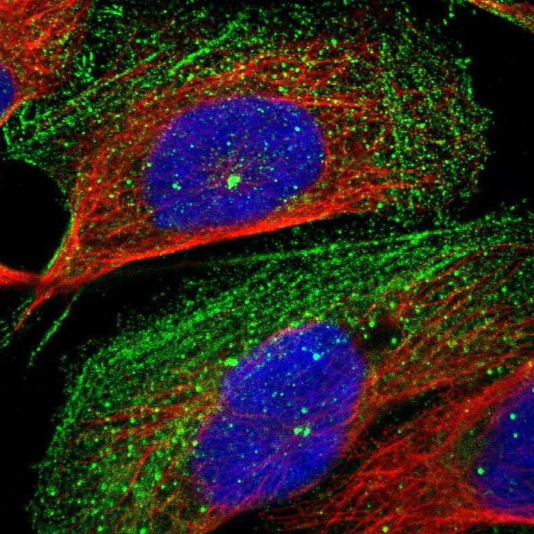 Immunocytochemistry - Anti-Rootletin antibody (AB121653)