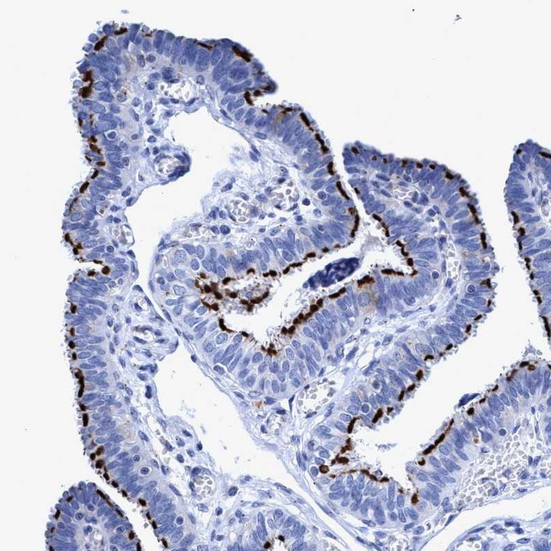 Immunohistochemistry (Formalin/PFA-fixed paraffin-embedded sections) - Anti-Rootletin antibody (AB121653), expandable thumbnail