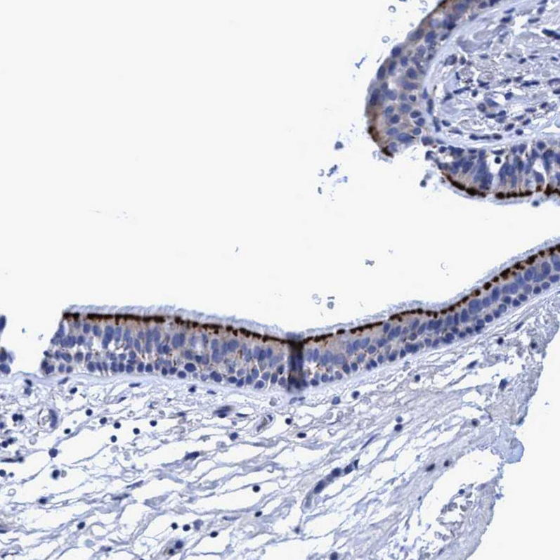 Immunohistochemistry (Formalin/PFA-fixed paraffin-embedded sections) - Anti-Rootletin antibody (AB121653), expandable thumbnail