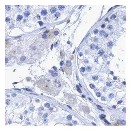 Immunohistochemistry (Formalin/PFA-fixed paraffin-embedded sections) - Anti-Rootletin antibody (AB121653)