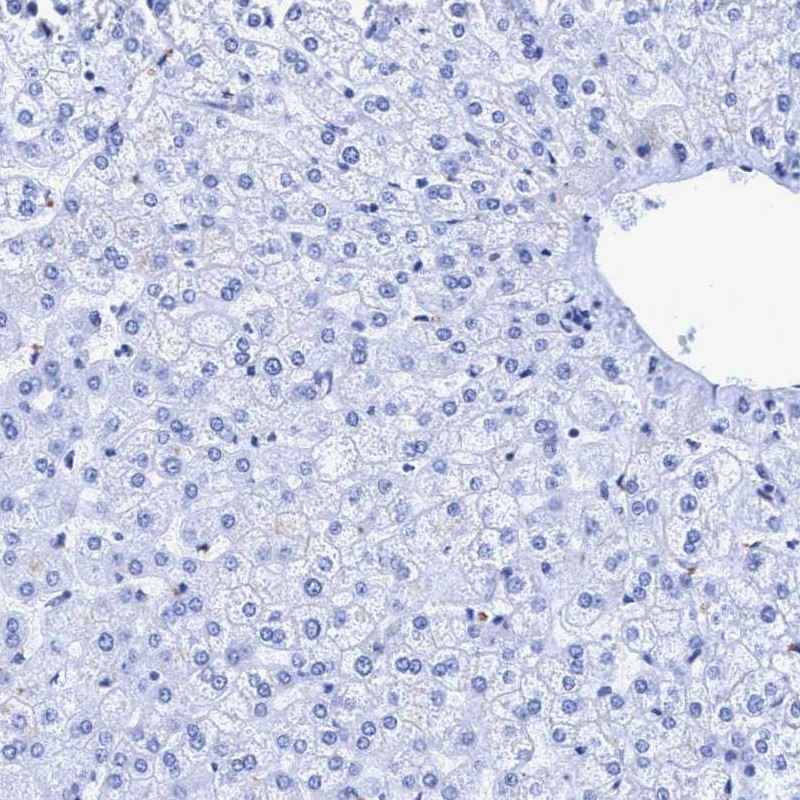 Immunohistochemistry (Formalin/PFA-fixed paraffin-embedded sections) - Anti-Rootletin antibody (ab121653), expandable thumbnail