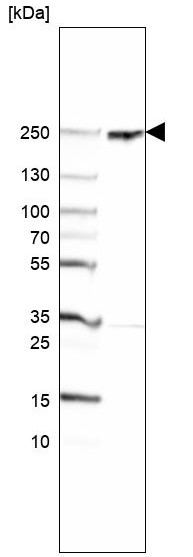 Western blot - Anti-Rootletin antibody (AB121653), expandable thumbnail