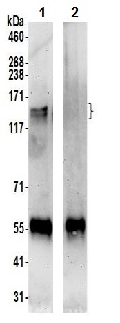 Immunoprecipitation - Anti-Roquin-2 antibody (AB241406)