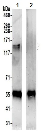 Immunoprecipitation - Anti-Roquin-2 antibody (AB241406)