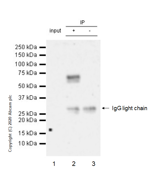 Immunoprecipitation - Anti-ROR alpha/RORA antibody [EPR23719-18] (AB256799), expandable thumbnail