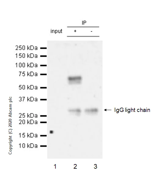 Immunoprecipitation - Anti-ROR alpha/RORA antibody [EPR23719-18] - BSA and Azide free (AB278108)