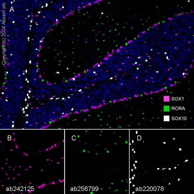 Multiplex immunohistochemistry - Anti-ROR alpha/RORA antibody [EPR23719-18] - BSA and Azide free (AB278108)