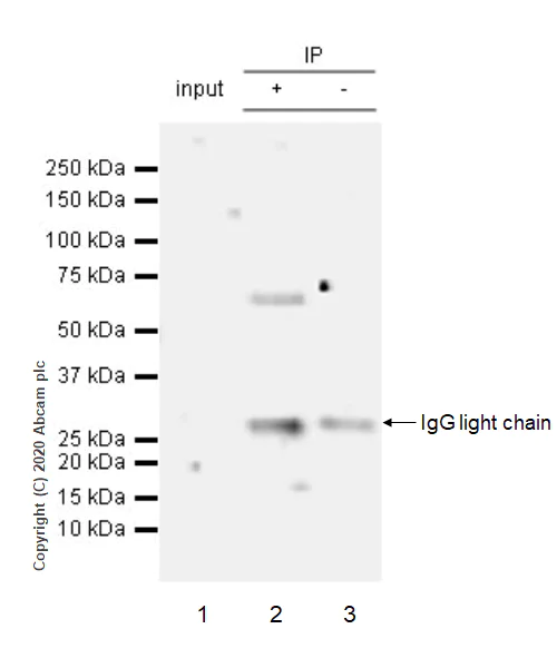 Immunoprecipitation - Anti-ROR alpha/RORA antibody [EPR23719-48] (AB278099)